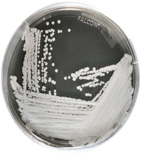 「耳念珠菌」是一種多重抗性藥性的超級真菌。