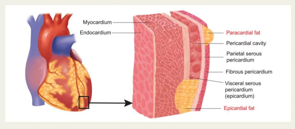 心臟脂肪的心外膜脂肪組織和心包脂肪組織